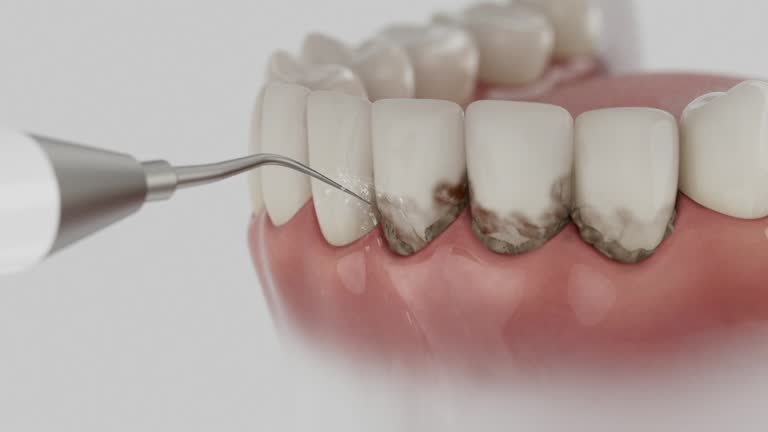 Trusted Dental Implants service in Garrison, ND - Dentist Open Now